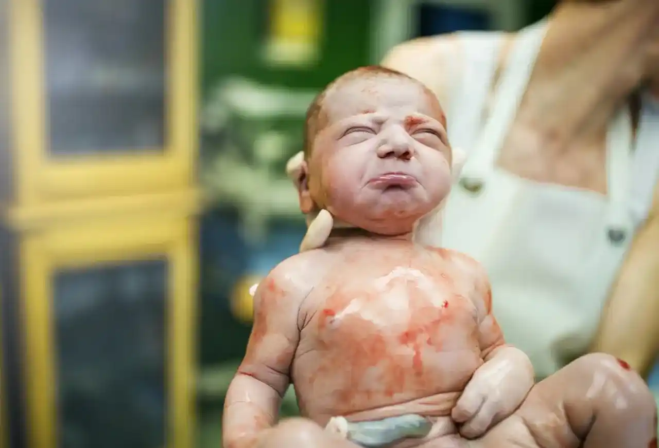 The injured baby while giving birth